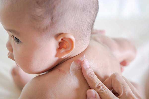 Kem chống hăm Sudocrem giúp làn da dịu nhẹ nhanh chóng